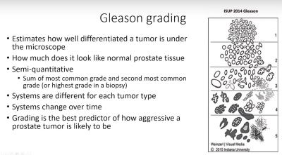 Gleason Cell Grades by appearance