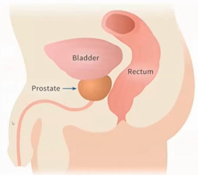 Prostate and Bladder and Rectum proximity