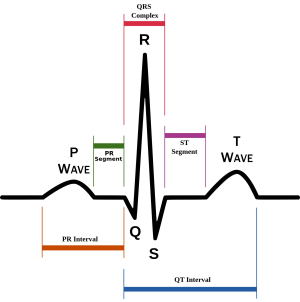 EKG/ECG: A signle heart beat cycle with the labeled segments.